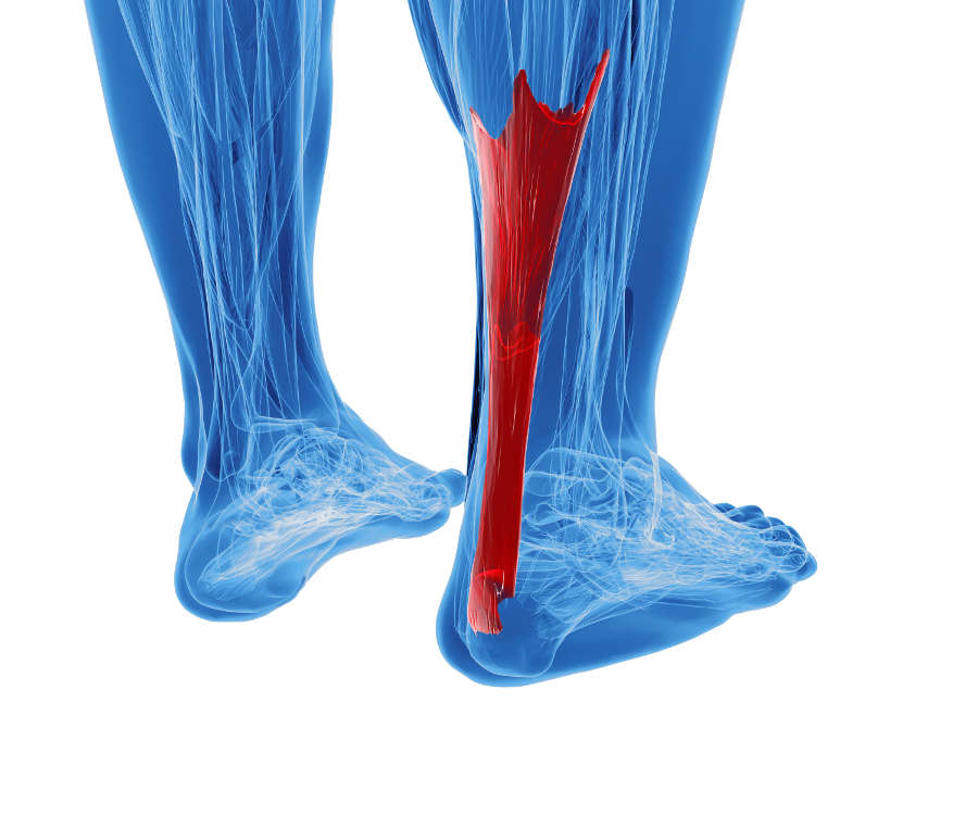 Achilles-tendinitis-to-be-treated-by-a-chiropractor-2.jpg